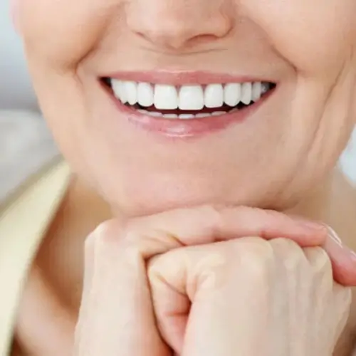 imagem de uma peciente de implantodontia sorrindo